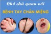 CHỚ CHỦ QUAN VỚI BỆNH TAY CHÂN MIỆNG