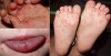 BIỆN PHÁP PHÒNG BỆNH TAY CHÂN MIỆNG